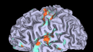 Conservatori o progressisti, lievi le differenze nel cervello